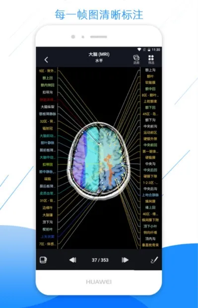 影像解剖图谱2026下载安装 影像解剖图谱2026下载安装